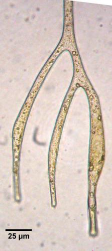 Amphisolenia thrinax
